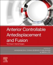 Anterior Controllable Antedisplacement and Fusion : Technique in Spinal Surgery