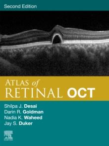 Atlas of Retinal OCT E-Book : Optical Coherence Tomography