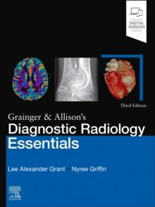 Grainger & Allison's Diagnostic Radiology Essentials E-Book