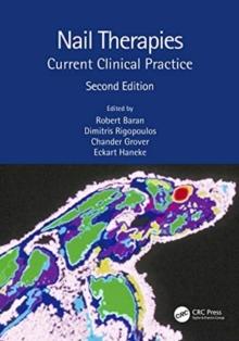 Nail Therapies : Current Clinical Practice