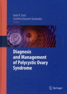 Diagnosis and Management of Polycystic Ovary Syndrome