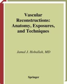 Vascular Reconstructions : Anatomy, Exposures and Techniques