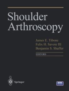 Shoulder Arthroscopy