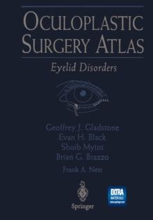 Oculoplastic Surgery Atlas : Eyelid Disorders