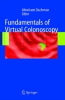 Fundamentals of Virtual Colonoscopy