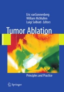 Tumor Ablation : Principles and Practice