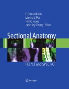 Sectional Anatomy : PET/CT and SPECT/CT