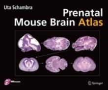 Prenatal Mouse Brain Atlas : Color images and annotated diagrams of: Gestational Days 12, 14, 16 and 18 Sagittal, coronal and horizontal section