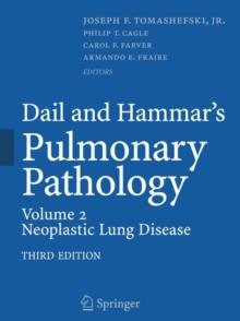 Dail and Hammar's Pulmonary Pathology : Volume II: Neoplastic Lung Disease