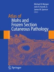 Atlas of Mohs and Frozen Section Cutaneous Pathology