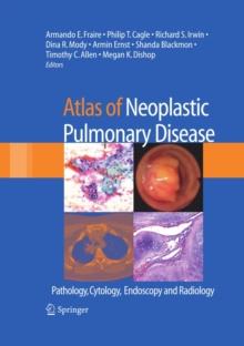 Atlas of Neoplastic Pulmonary Disease : Pathology, Cytology, Endoscopy and Radiology