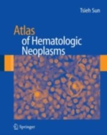 Atlas of Hematologic Neoplasms