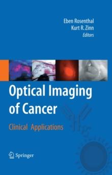 Optical Imaging of Cancer : Clinical Applications