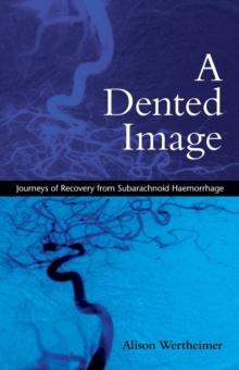 A Dented Image : Journeys of Recovery from Subarachnoid Haemorrhage