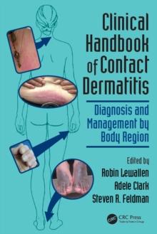 Clinical Handbook of Contact Dermatitis : Diagnosis and Management by Body Region