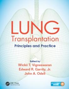 Lung Transplantation : Principles and Practice