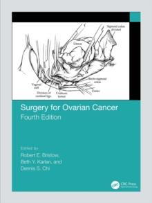 Surgery for Ovarian Cancer