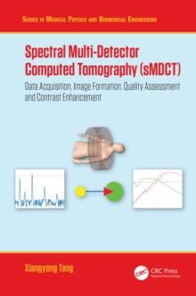 Spectral Multi-Detector Computed Tomography (sMDCT) : Data Acquisition, Image Formation, Quality Assessment and Contrast Enhancement