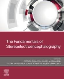 The Fundamentals of Stereoelectroencephalography