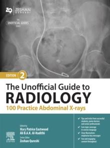 The Unofficial Guide to Radiology: 100 Practice Abdominal X-rays