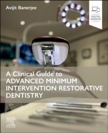 A Clinical Guide to Advanced Minimum Intervention Restorative Dentistry