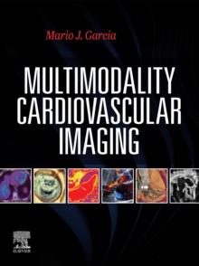 Multimodal Cardiac Imaging - E-Book