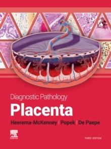 Diagnostic Pathology: Placenta : Diagnostic Pathology: Placenta - E-BOOK