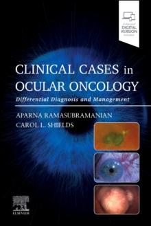 Clinical Cases in Ocular Oncology : Differential Diagnosis and Management