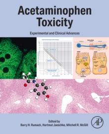 Acetaminophen Toxicity : Experimental and Clinical Advances