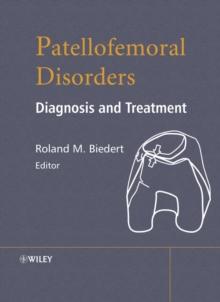 Patellofemoral Disorders : Diagnosis and Treatment