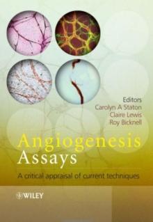 Angiogenesis Assays : A Critical Appraisal of Current Techniques