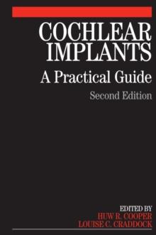 Cochlear Implants : A Practical Guide