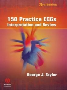 150 Practice ECGs : Interpretation and Review