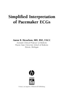 Simplified Interpretation of Pacemaker ECGs