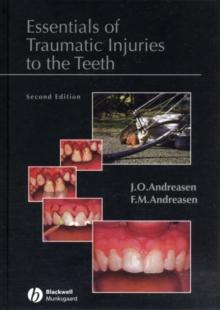 Essentials of Traumatic Injuries to the Teeth : A Step-by-Step Treatment Guide