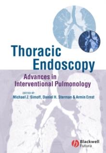 Thoracic Endoscopy : Advances in Interventional Pulmonology