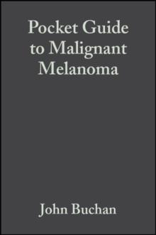 Pocket Guide to Malignant Melanoma