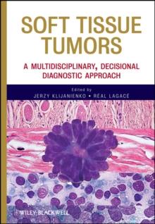 Soft Tissue Tumors : A Multidisciplinary, Decisional Diagnostic Approach