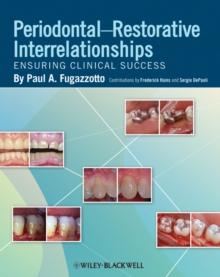 Periodontal-Restorative Interrelationships : Ensuring Clinical Success