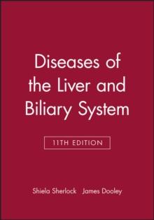 Diseases of the Liver and Biliary System