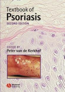 Textbook of Psoriasis