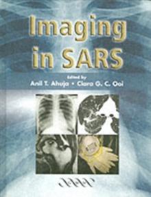 Imaging in SARS