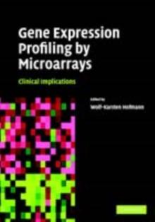 Gene Expression Profiling by Microarrays : Clinical Implications