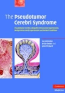 Pseudotumor Cerebri Syndrome : Pseudotumor Cerebri, Idiopathic Intracranial Hypertension, Benign Intracranial Hypertension and Related Conditions