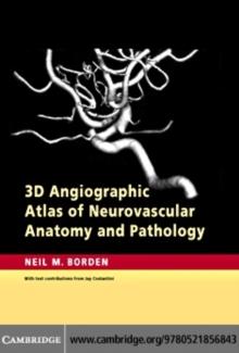 3D Angiographic Atlas of Neurovascular Anatomy and Pathology