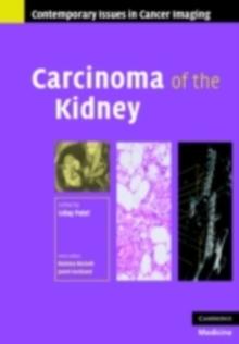 Carcinoma of the Kidney