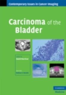 Carcinoma of the Bladder