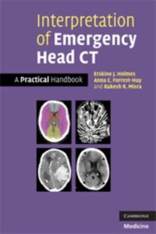 Interpretation of Emergency Head CT : A Practical Handbook