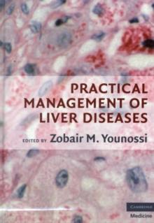 Practical Management of Liver Diseases