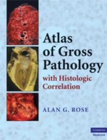 Atlas of Gross Pathology : With Histologic Correlation